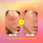 Calm Me Down Antioxidant Cleanser